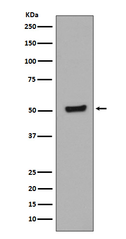 WB - Anti-Phospho-p53 (T55) TP53 Rabbit Monoclonal Antibody ABO13105